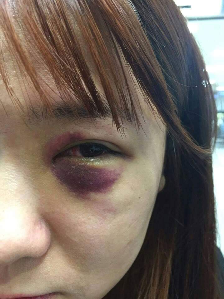 전라도 광주에서 남자 4명이 남자1명 여자2명 폭행하고 도망감 | 인스티즈