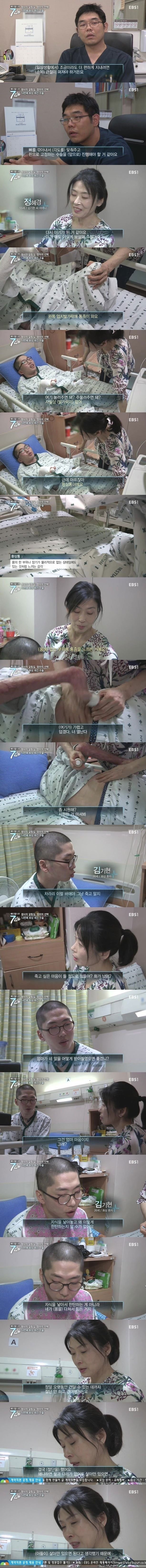 화상 환자들이 겪는 고통.jpg | 인스티즈