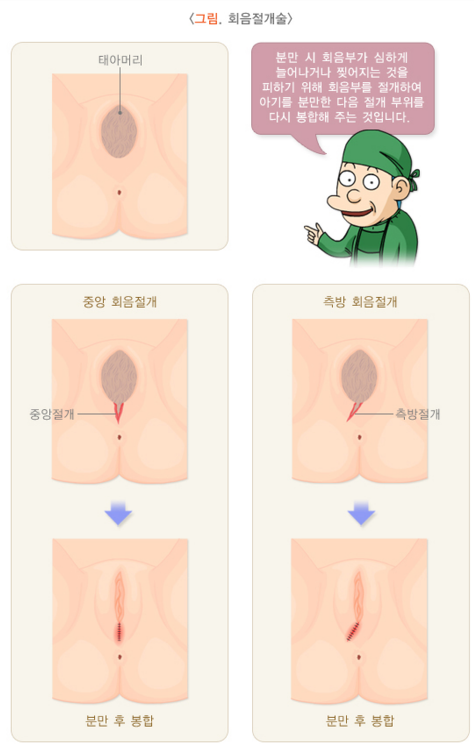 학교나 사회가 알려주지 않는 임신과 출산의 진짜 현실 | 인스티즈