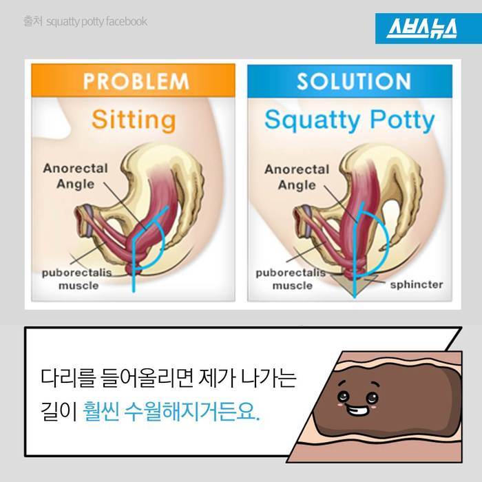 변비 해결을 위한 올바른 자세.JPG | 인스티즈
