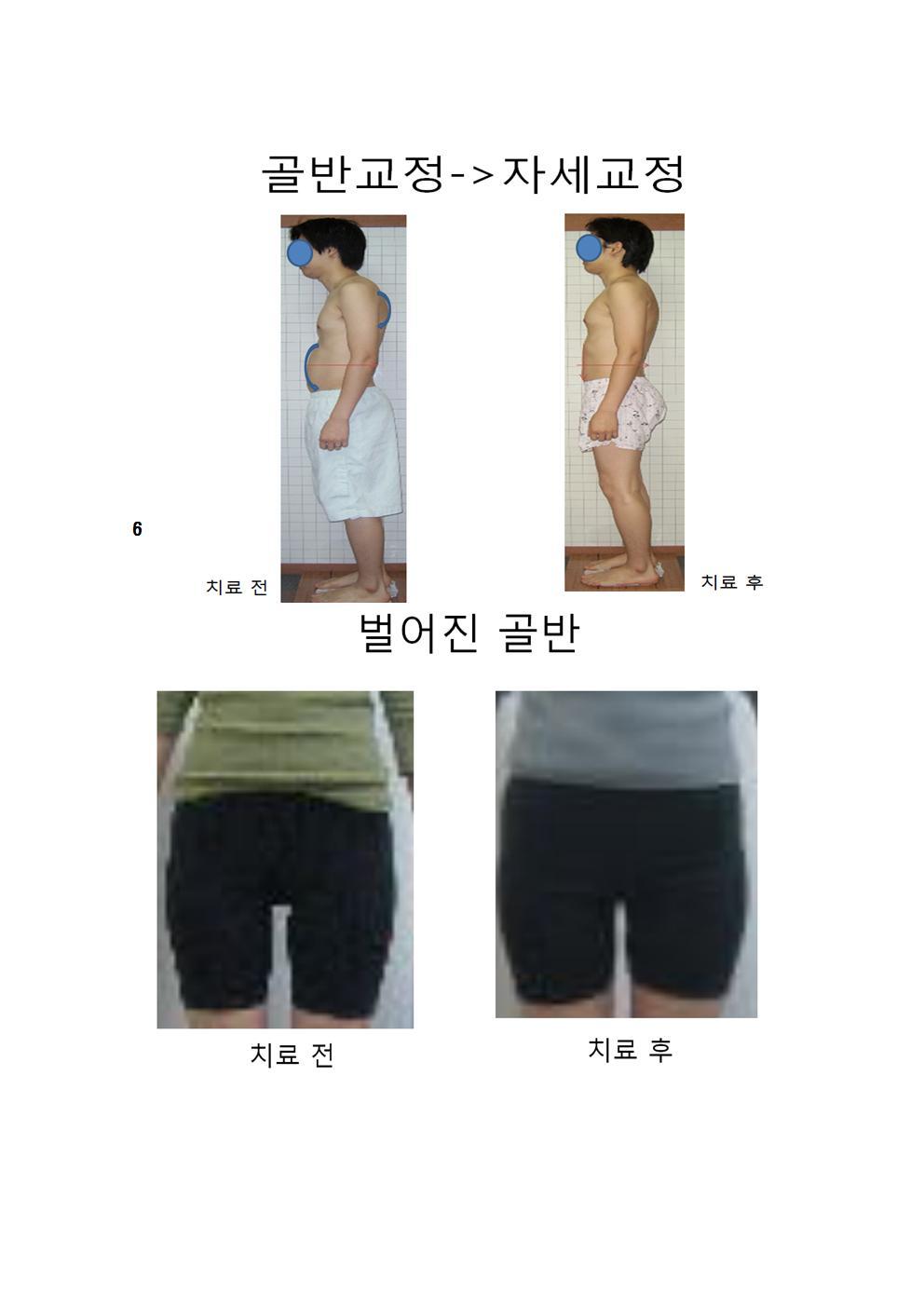국제척추교정학회 이미지