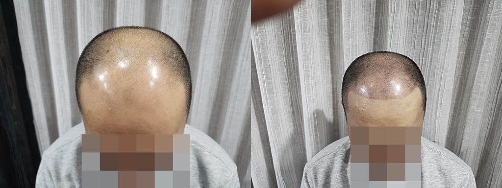 김포타투여명 이미지