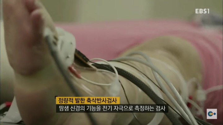 아픔을 느낄 수 없다면 좋은걸까? 무통증 환자 삼남매 이야기. #2 | 인스티즈