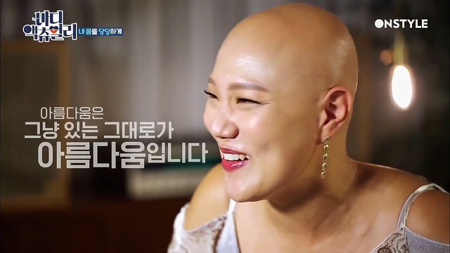 전신탈모증 윤사비나씨가 생각하는 아름다움.jpg | 인스티즈