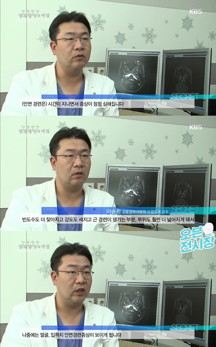 눈 밑 떨림이 2개월 이상 지속될 경우에 의심해봐야 할 질병.jpg | 인스티즈