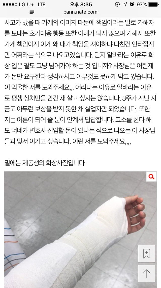 [긴급] 억울하고 부당한 화상입은 알바생의 최후!!!!! | 인스티즈