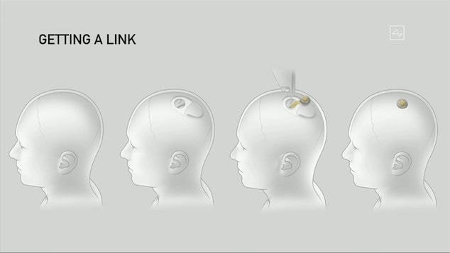 일론 머스크, 뉴럴링크 이식한 돼지 소개 | 인스티즈